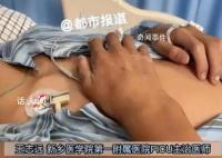 14岁男孩凌晨口渴误喝百草枯 如今命悬一线