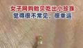 女子称老公吃贻贝吐出多颗珍珠 越吃越多