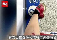 女子带娃路过公园 被3条流浪狗围攻