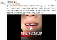 女子平躺玩手机 被砸断半颗门牙