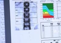 女子每天3杯咖啡被确诊骨质疏松 你喜欢喝咖啡吗