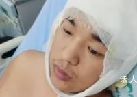 考研在即大四男生割皮救母 只要能救俺妈我植多少皮都中