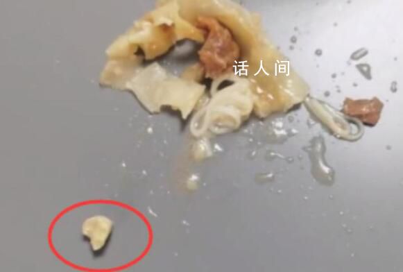 孩子在云吞中吃出牙齿?家长投诉