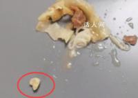 孩子在云吞中吃出牙齿?家长投诉