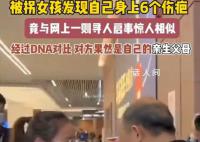 女孩身上6个伤疤同寻人启事一致 没想到世界的另一头果然有人在等我