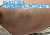 陕西月子会所护工把婴儿打成脑损伤 监控画面曝更多细节