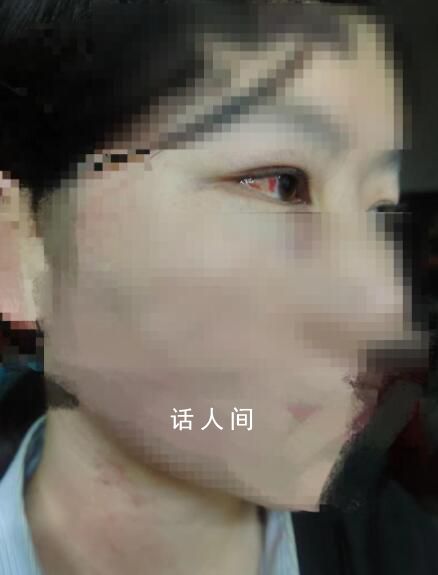 悬赏找打人者事件3人已被抓 均为未成年