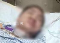 40岁女子花6万隆胸后昏迷数月 家属指责医美机构存在多项问题