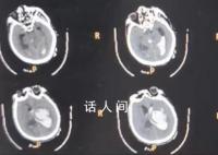 男子喂猪时晕倒 遭家猪啃食下半身