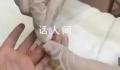 医生给孩子采血手套残留他人血迹 家长质疑后但却遭到医生无视