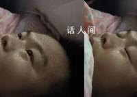男子同时患甲流支原体烧到额头冒烟 网友：汗流浃背了