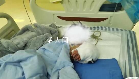 男童手臂伸进笼子被藏獒咬断 经过6个小时的手术成功接上