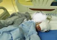 男童手臂伸进笼子被藏獒咬断 经过6个小时的手术成功接上
