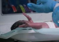 当一名艾滋病感染者决定结婚生娃 HIV感染者普遍晚婚晚育