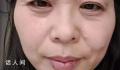 断崖式衰老女子本以为能漂亮过余生 没想到来这么当头一棒