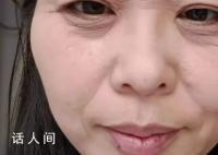 断崖式衰老女子本以为能漂亮过余生 没想到来这么当头一棒