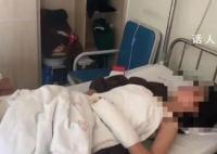 女子称与物业起冲突一家三口被打 保安将其孩子手筋打断两根