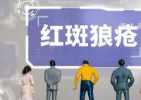 红斑狼疮曾被称为世界三大疑难病 红斑狼疮被称“不死的癌症”