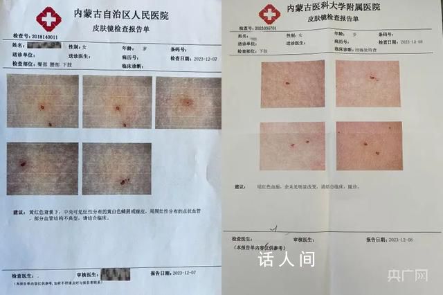媒体:女童被扎事件须尽快给个交代