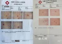 媒体:女童被扎事件须尽快给个交代