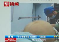 23岁女子腹胀如鼓取出42斤肿瘤 比怀足月双胞胎的孕妇肚子还要大