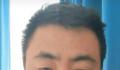 详解“3娃非亲生案”5大法律问题 涉嫌欺诈性抚养具体数额确认是司法难点