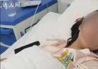 姐姐与妹妹争吵后将其双手肌腱割断 这也太狠毒了