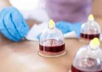 女子每周拔罐放血200ml致重度贫血 频繁拔罐放血让金阿姨皮肤毛细血管受损
