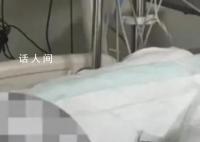 男子误服200ml防冻液喝白酒救命 经过半个月后续治疗这名患者脱离了危险