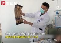 女生每月3次月经 脑部查出垂体瘤