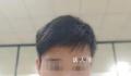 小伙拔牙拍片时晕倒 开颅手术后去世