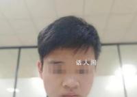 小伙拔牙拍片时晕倒 开颅手术后去世