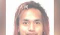 在美被泼液体中国女子或永久毁容 身体大部分部位被烧伤