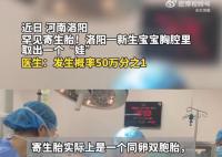 河南医生成功分离罕见胎中胎 手术后的男婴身体状况良好