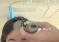 “点读机女孩”高君雨自曝患脑瘤 录下了用电动剃刀剃光头发的过程