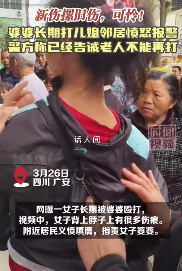 婆婆将儿媳打得满身疤痕 邻居报警