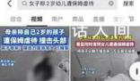 女子称2岁女儿遭保姆虐待撞击头部 力度之大令人震惊