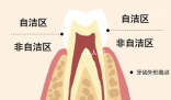 刷牙最该刷的其实不是牙齿 你真的会刷牙吗？